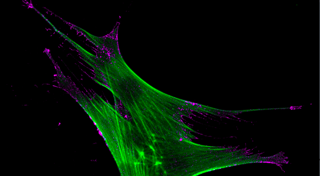 CAR-MSCs: the New Drivers of Immune System Regulation 
