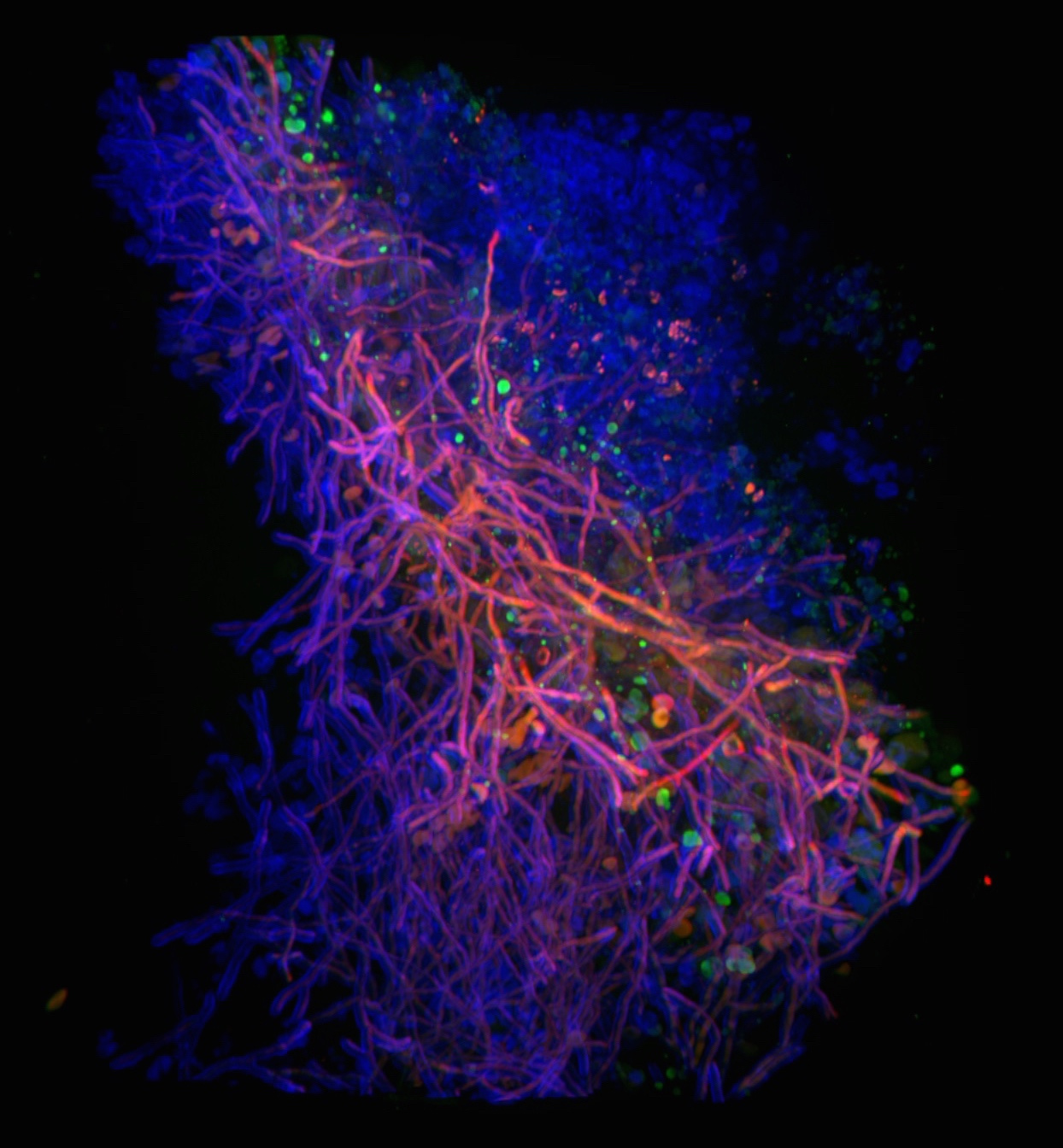 Fungal “looks” can take your breath away