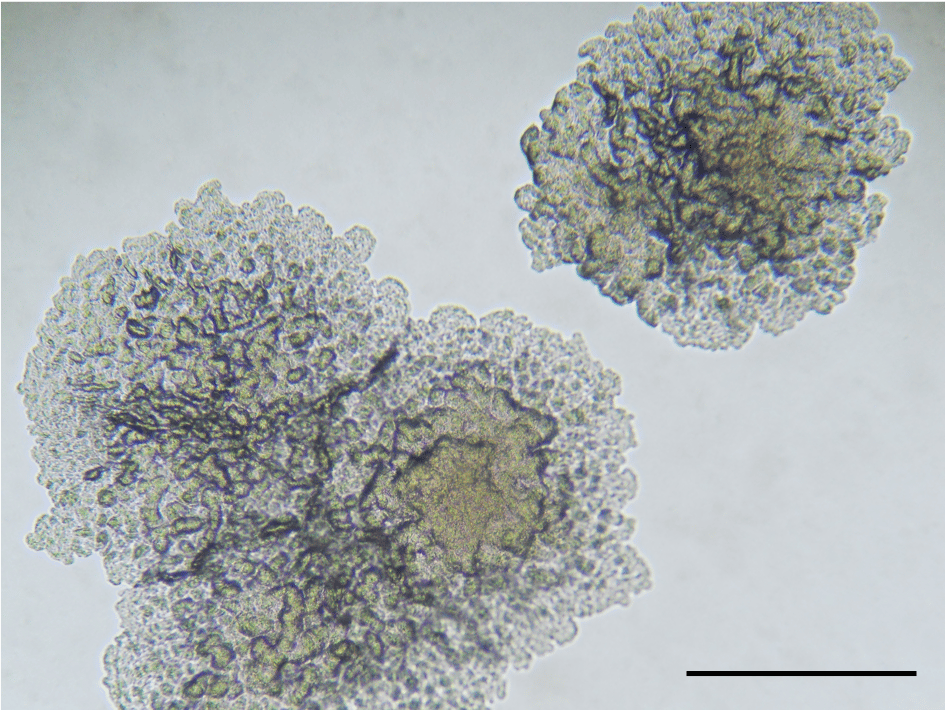 Discovery of a new Mycobacterium tuberculosis lineage and the transcontinent collaboration behind it