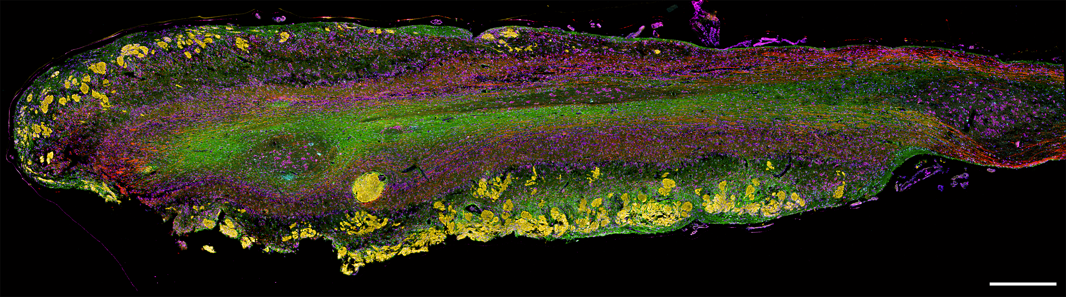 Painting the brain: multiplex immunohistochemistry of the human olfactory bulb in normal ageing and disease
