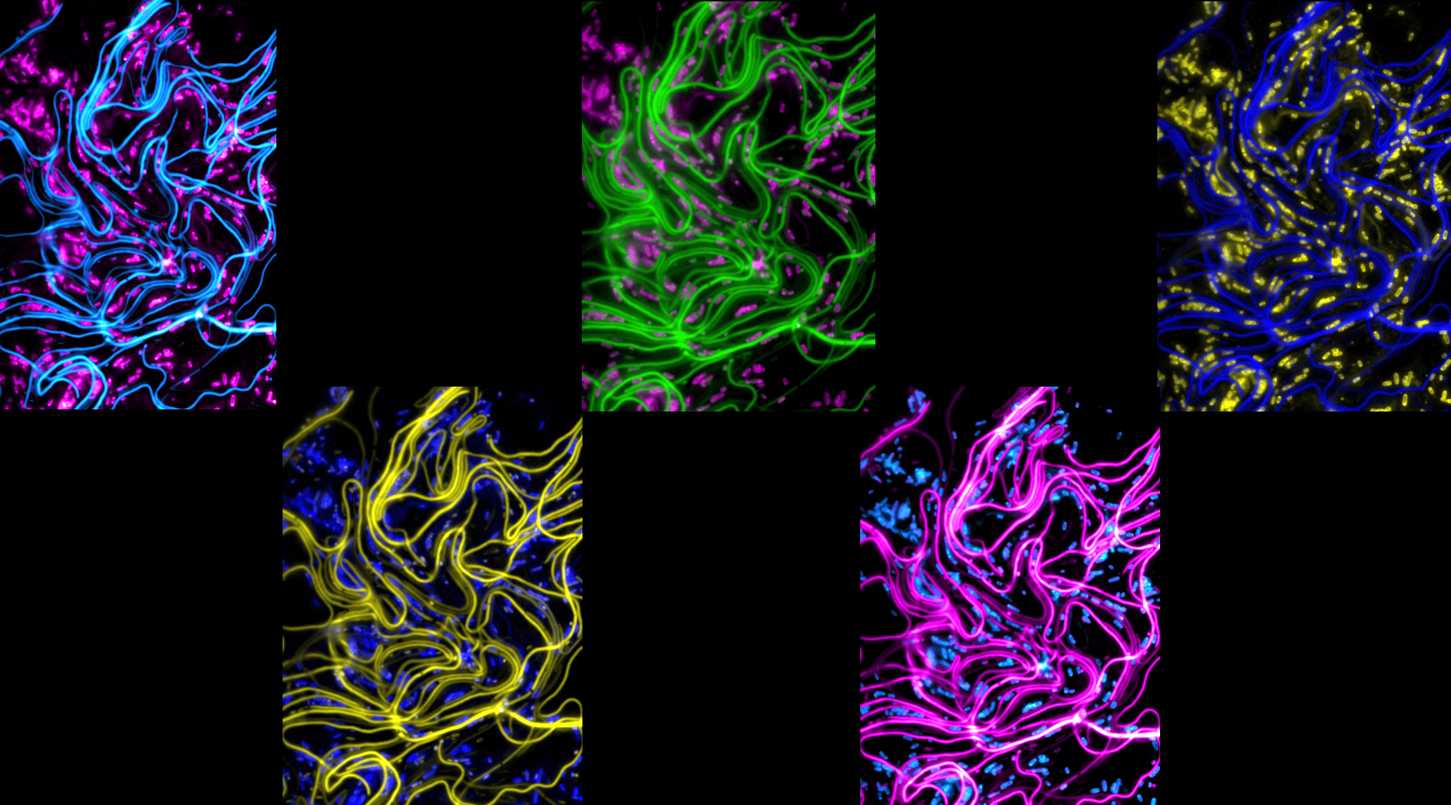 Understanding infection-related filamentation and reversal of Uropathogenic E. coli