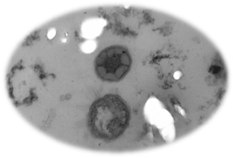 Dominant green sulfur bacteria inside coral skeleton