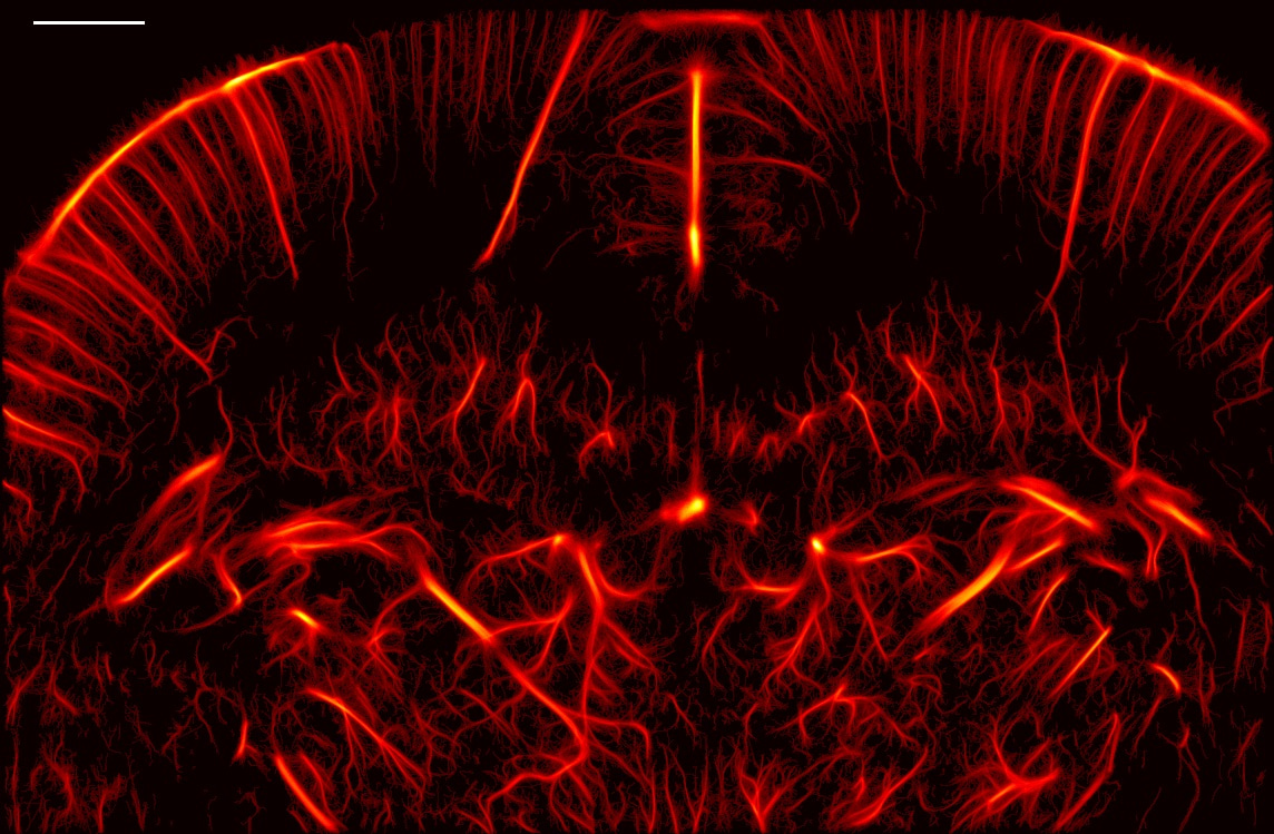 Performance benchmarking of microbubble-localization algorithms for ultrasound localization microscopy