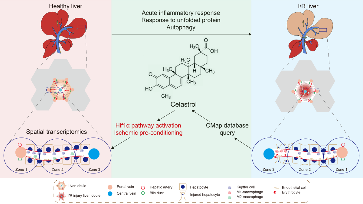 Location, location, location: a spatial perspective of liver heterogeneity in physiological and pathological contexts