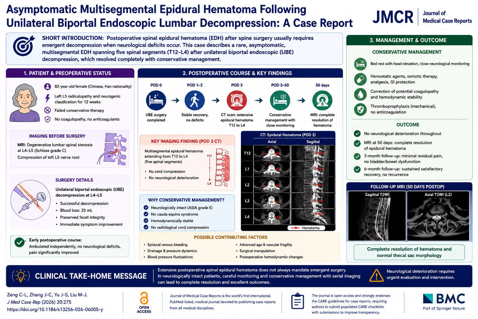 Asymptomatic Multisegmental Epidural Hematoma After Unilateral Biportal Endoscopic Lumbar Decompression: Challenging Conventional Surgical Paradigms