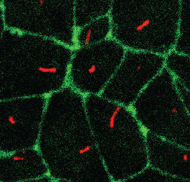 Cilia-Free Stem Cells