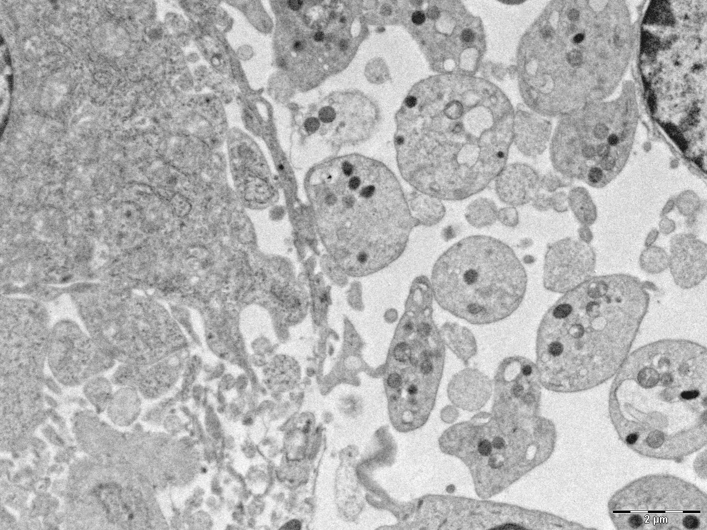 Calreticulin del52 and ins5 knock-in mice recapitulate different myeloproliferative phenotypes observed in patients with MPN