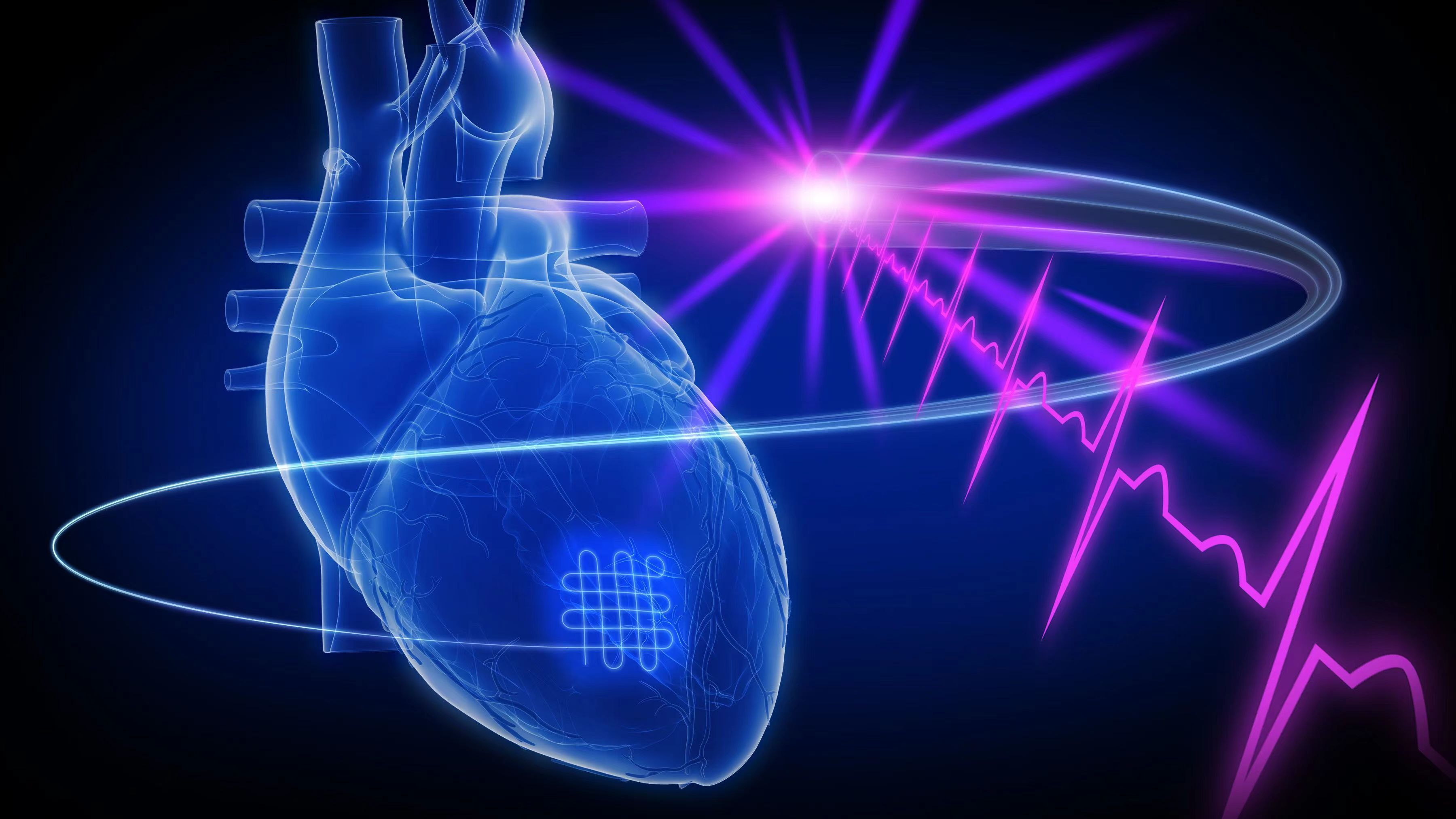 Two-way workable solution to infarcted heart: Hydrogel suture as a patch and sensor for monitoring, diagnosing and repairing