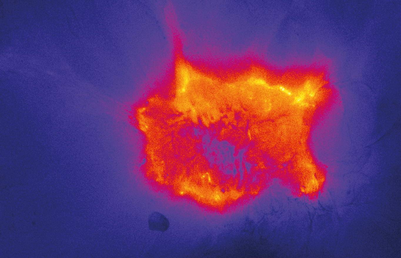 Exploiting metabolic acidosis in solid cancers using a tumor-agnostic pH-activatable nanoprobe for fluorescence-guided surgery