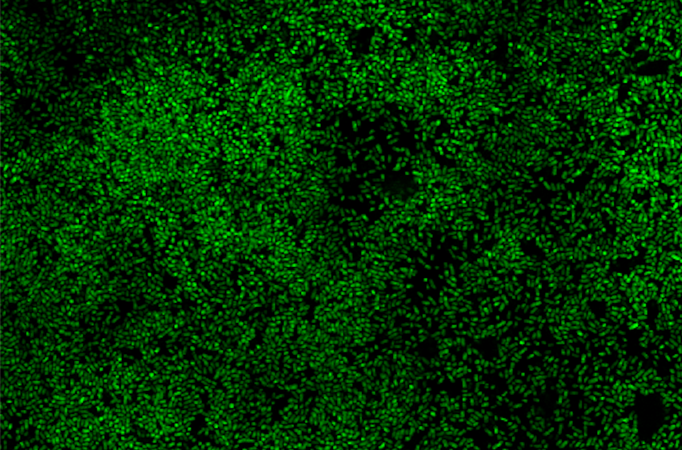 One protein, many functions: SslE, the E. coli mucin degrading enzyme that facilitates biofilm formation