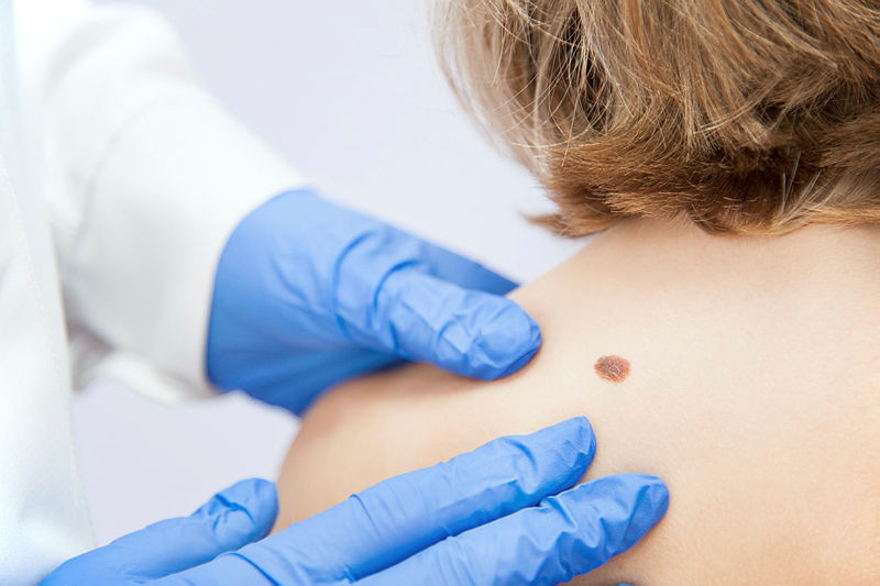 Editors' highlights: Skin Cancer Awareness Month 