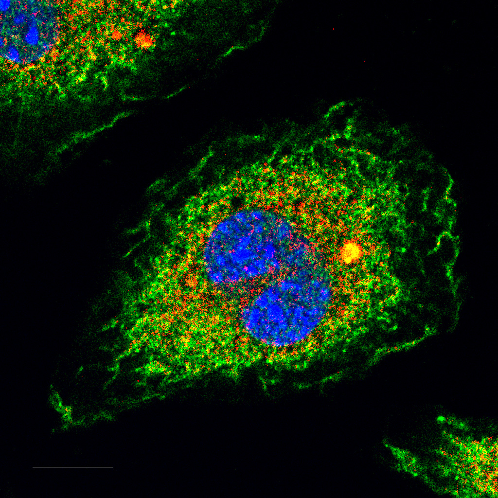 RhoGTPases-activating bacterial toxins: The NLRP3 inflammasome fight back