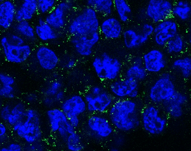 Turning leukemia cell death into an immune alarm