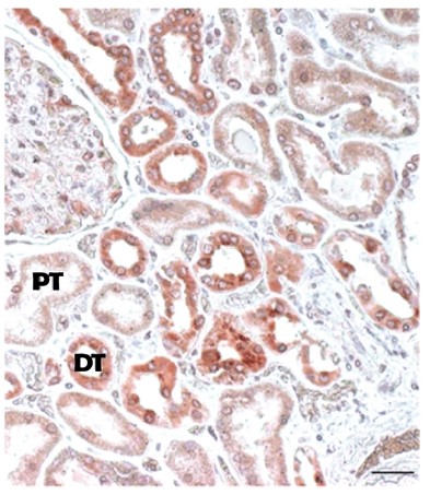 Finding the glucagon receptor using antibodies - not a good idea 