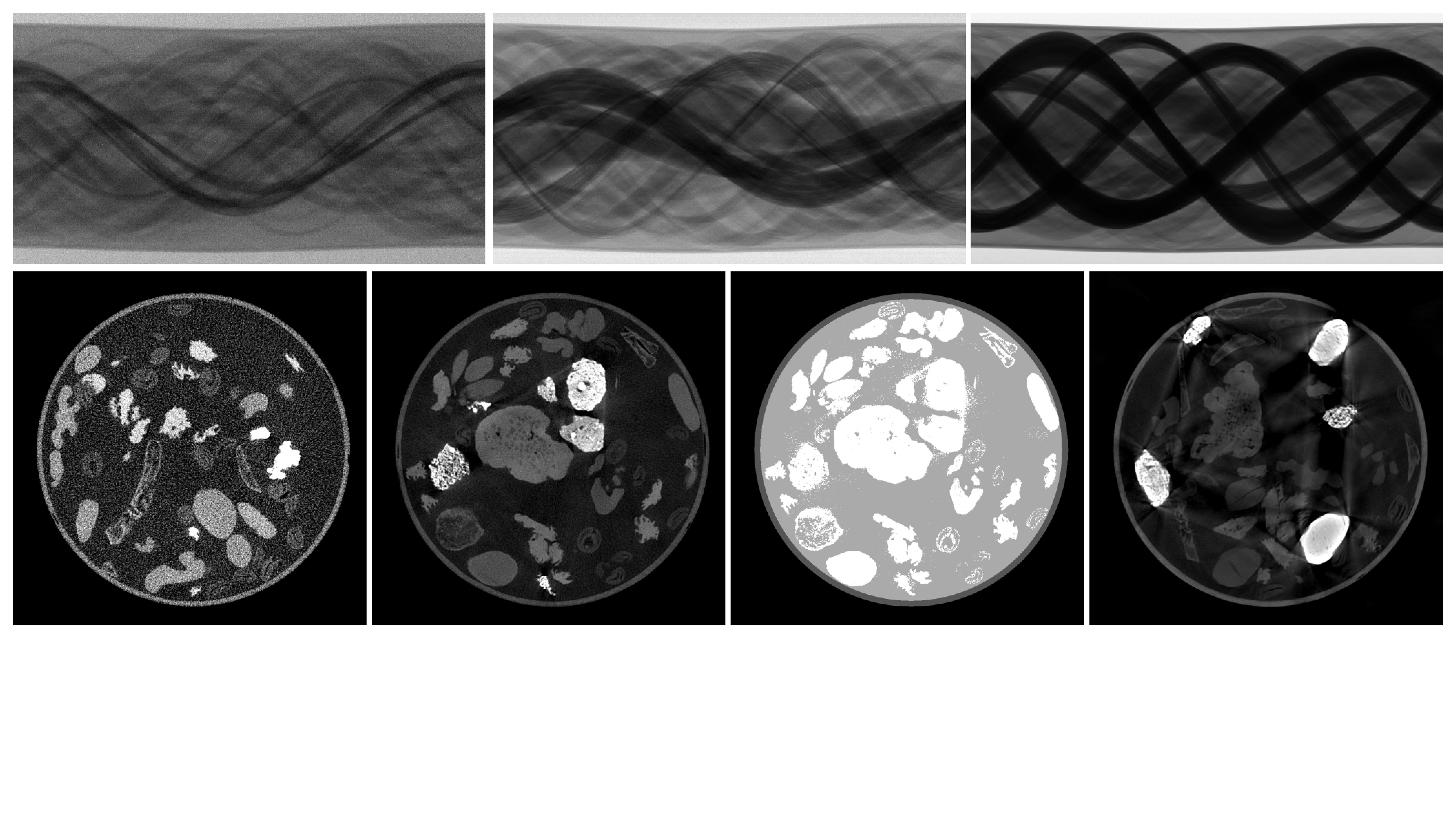 2DeteCT - A large 2D expandable, trainable, experimental Computed Tomography dataset for machine learning