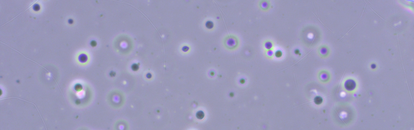 On the origin of life: Endocytosis-like DNA uptake by cell wall-deficient bacteria