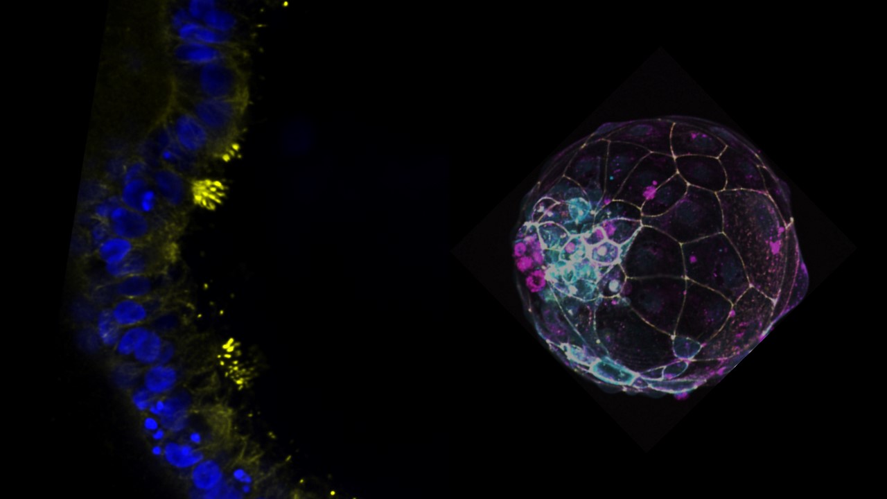 Naturally simple: the self-organization of human blastoids