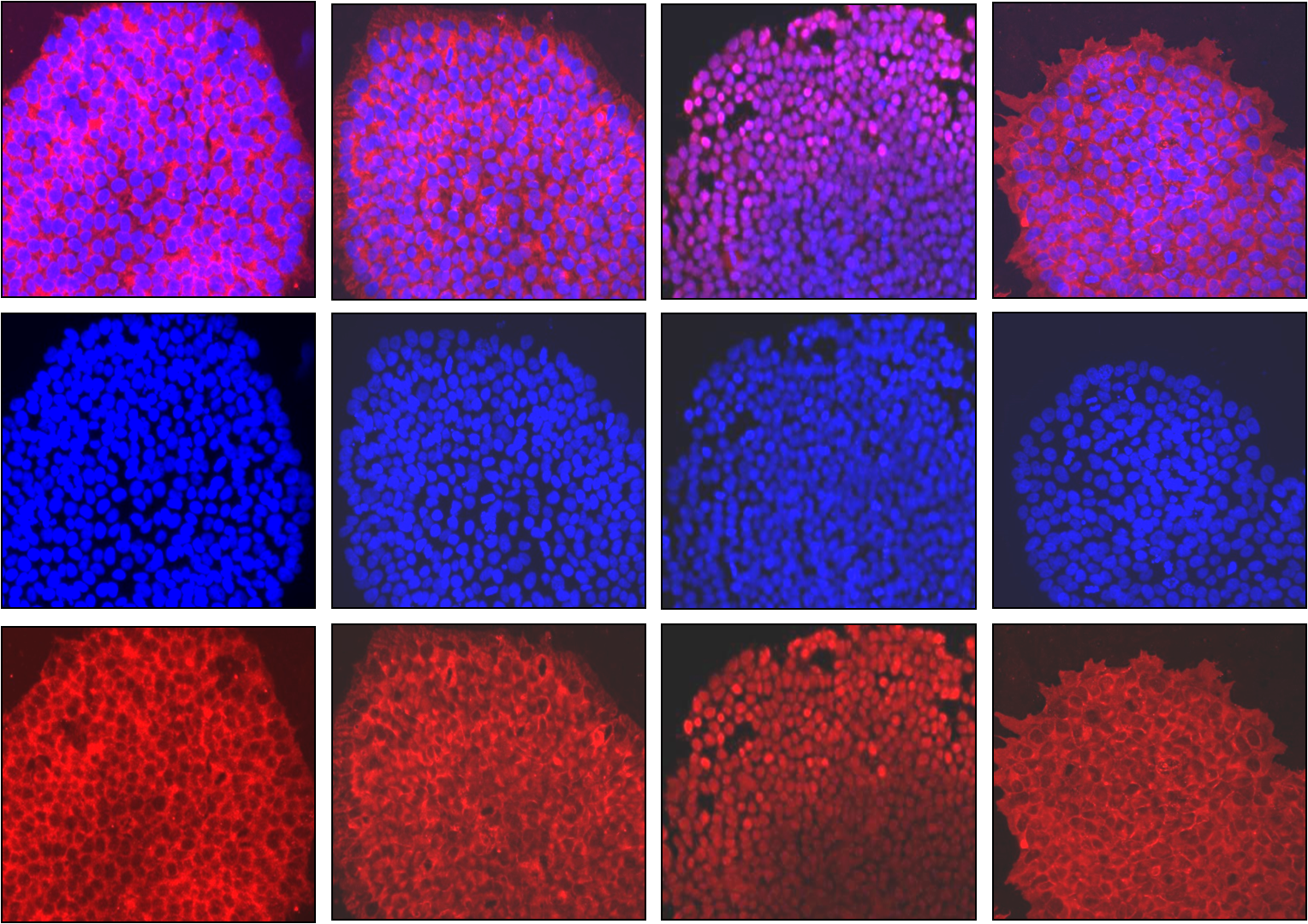 Targeting CREB-binding protein (CBP) abrogates colorectal cancer stemness through epigenetic regulation of C-MYC