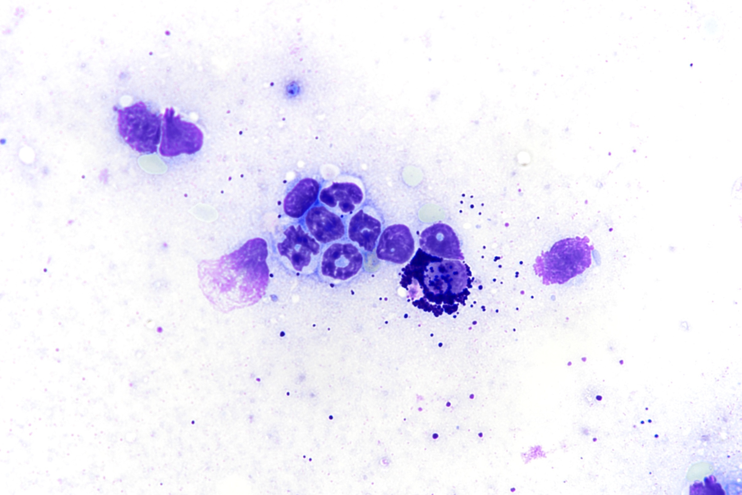 Advancing systemic mastocytosis research through a novel pre-clinical model