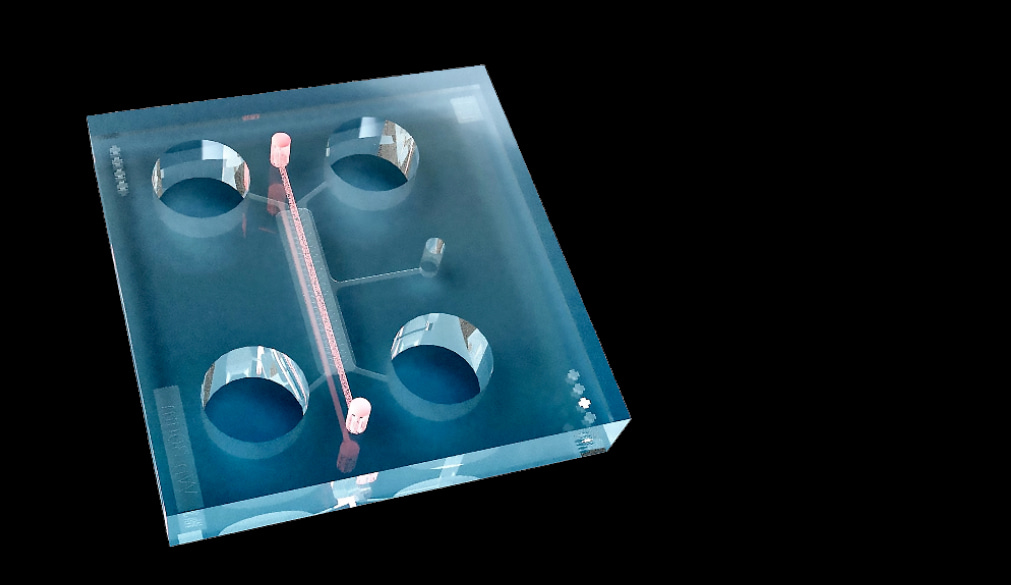 Hyperphysiological compression of articular cartilage induces an osteoarthritic phenotype  in a cartilage-on-a-chip model