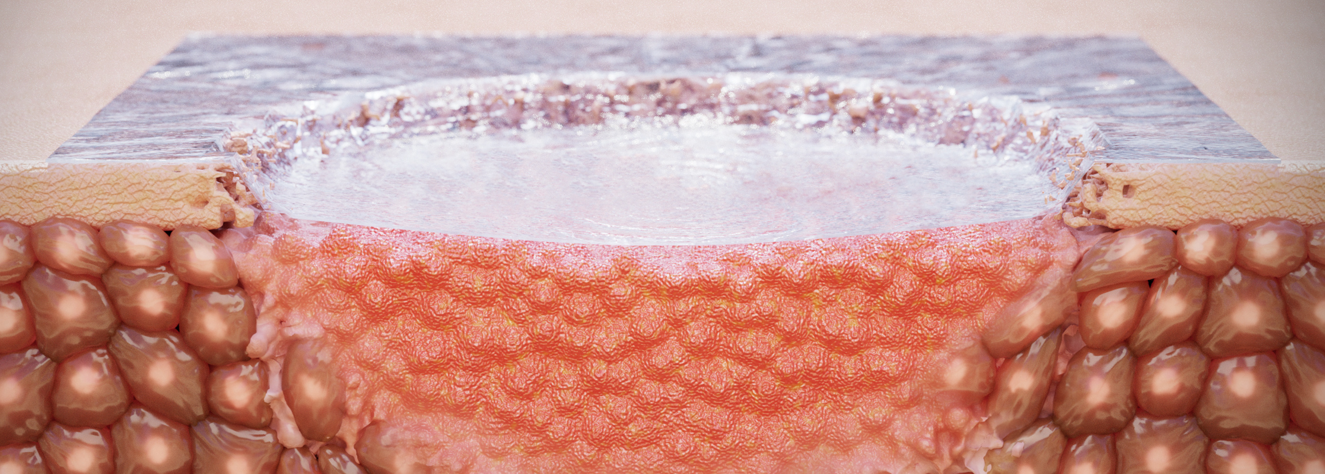 Strain-Programmed Patch for Diabetic Wound Healing