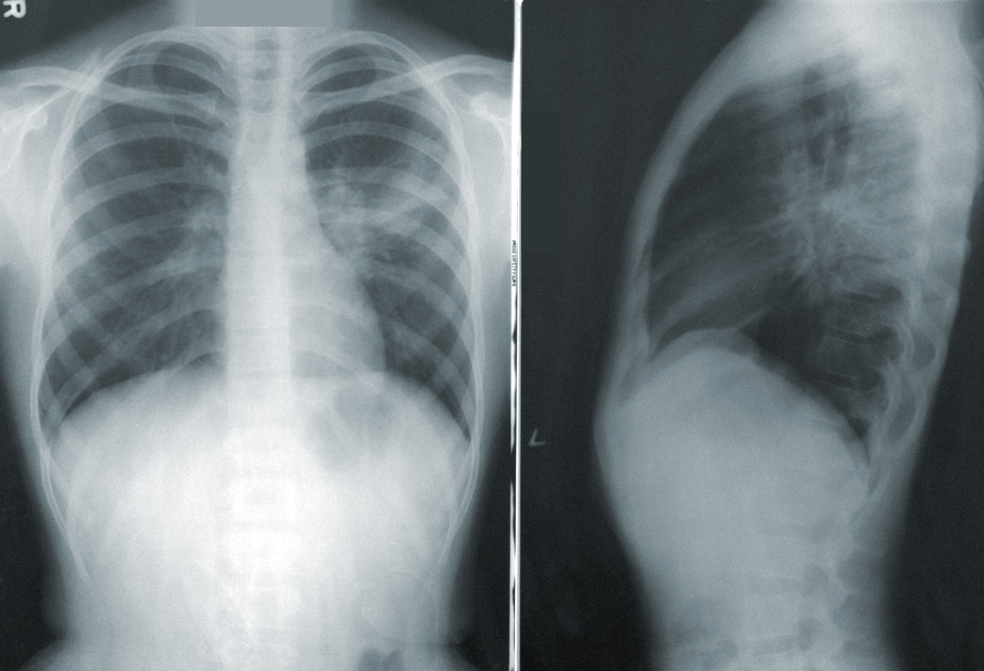 Investigating physician trust in AI systems: where is the line between effective collaboration and over-reliance?