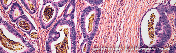 Collection: Colorectal Cancer Awareness Month