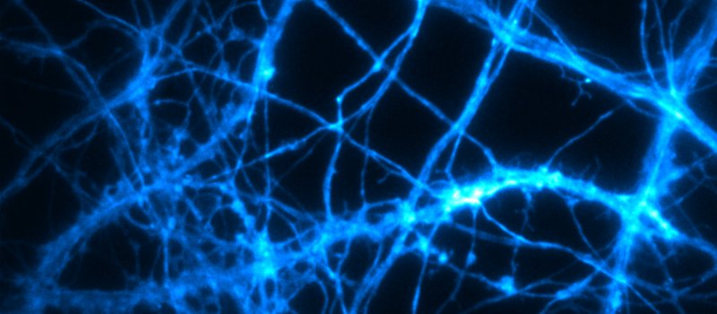 Event-triggered STED imaging