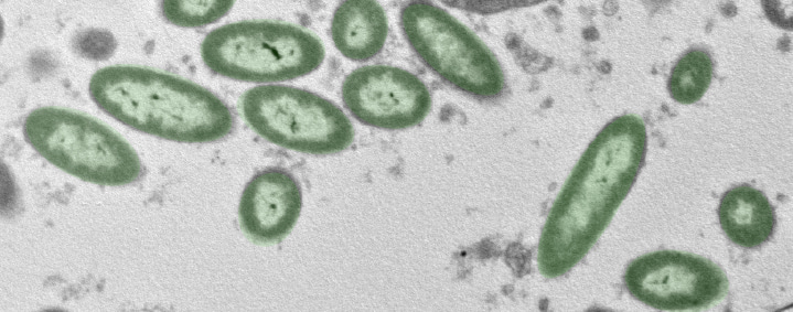 Beneficial Microbes in Microgravity