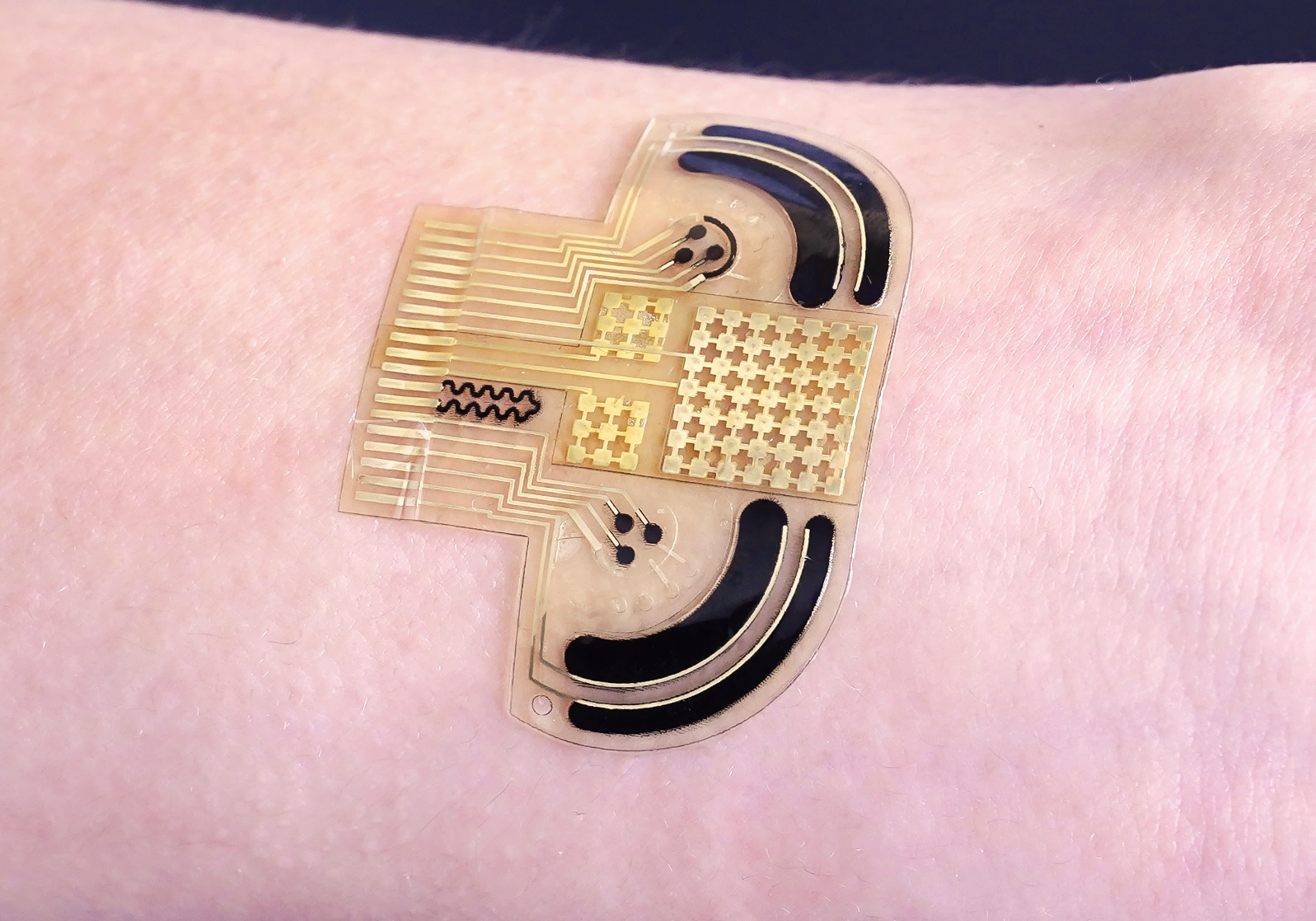 Evaluating Stress with Artificial Intelligence-Powered Electronic Skin