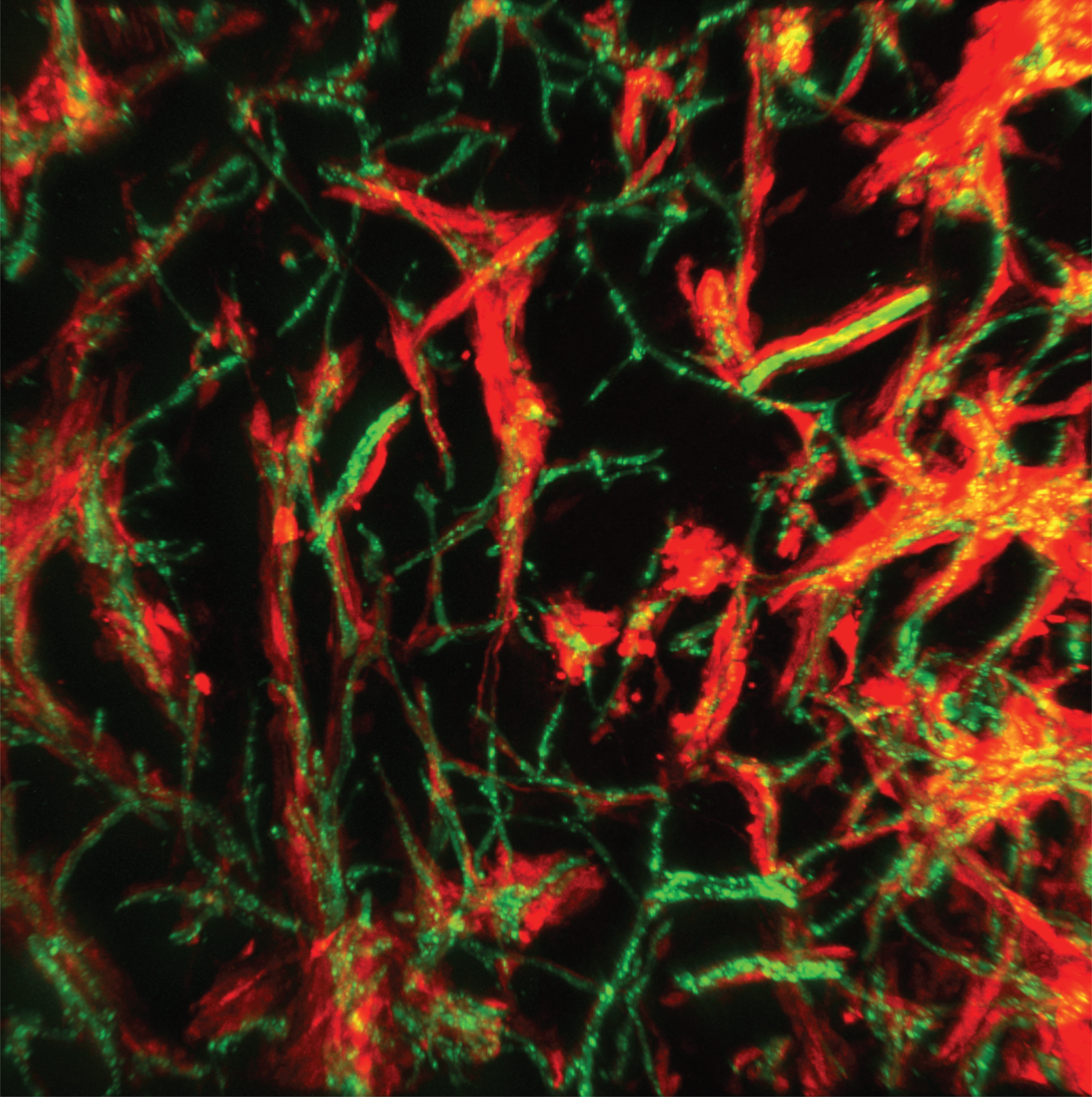 PTEN-restoration abrogates brain colonisation and perivascular niche invasion by melanoma cells