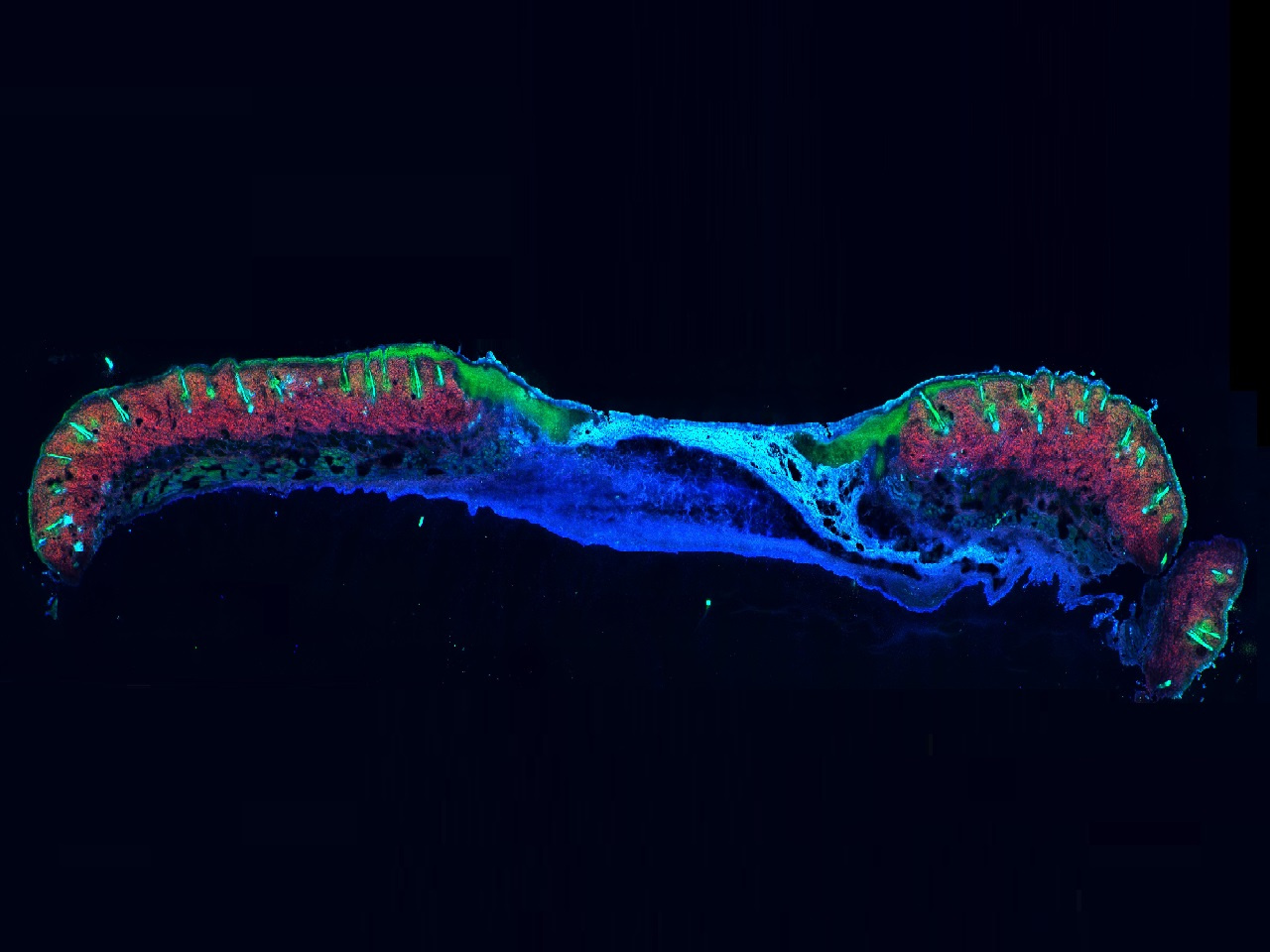 In vivo multiphoton microscopy detects longitudinal changes associated with delayed skin wound healing