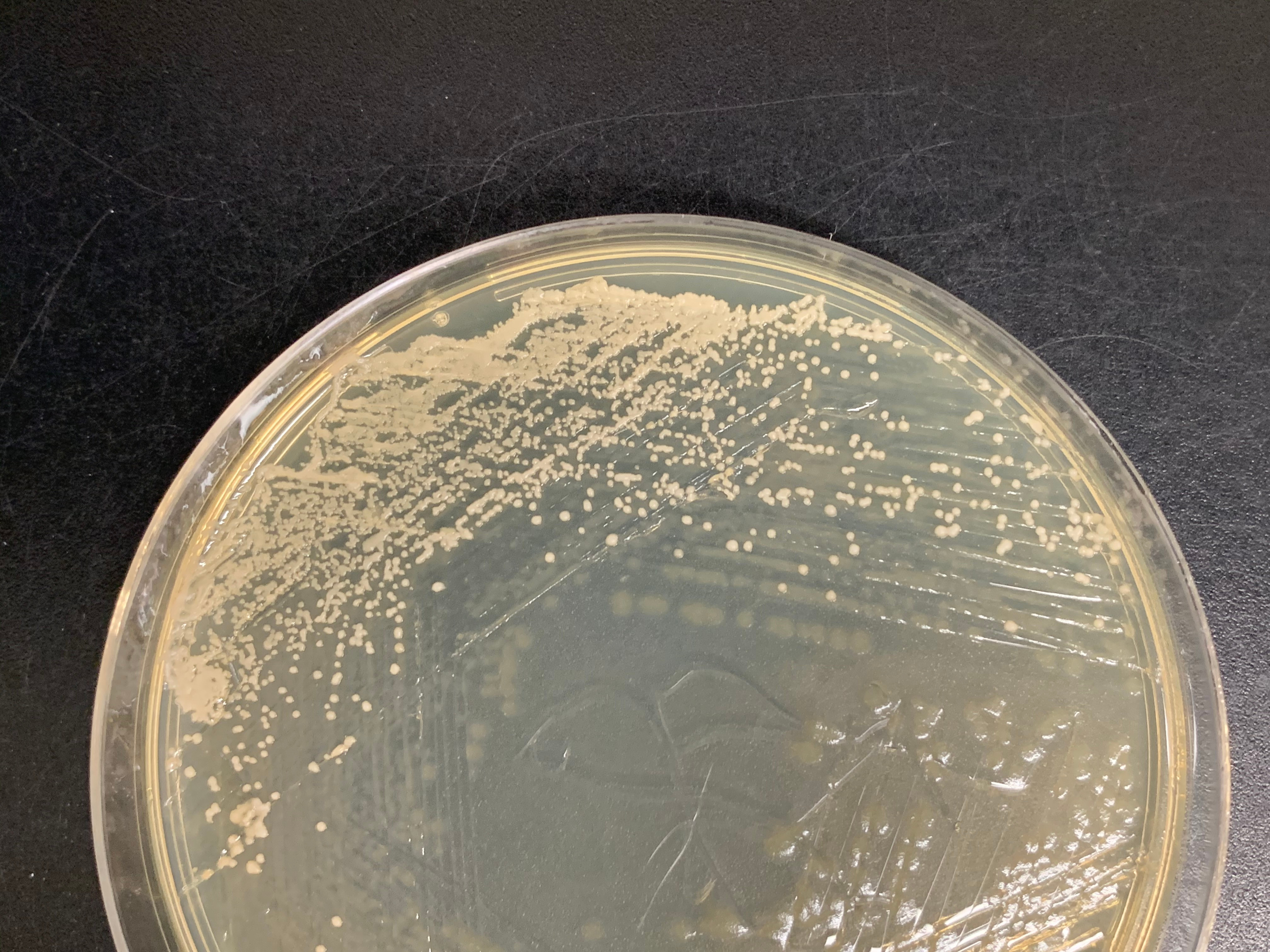 Stuck in the middle with you: Coevolution in microbes