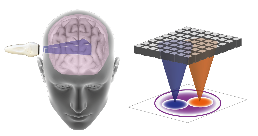 Seeing through the skull with 3D ultrasound matrix imaging