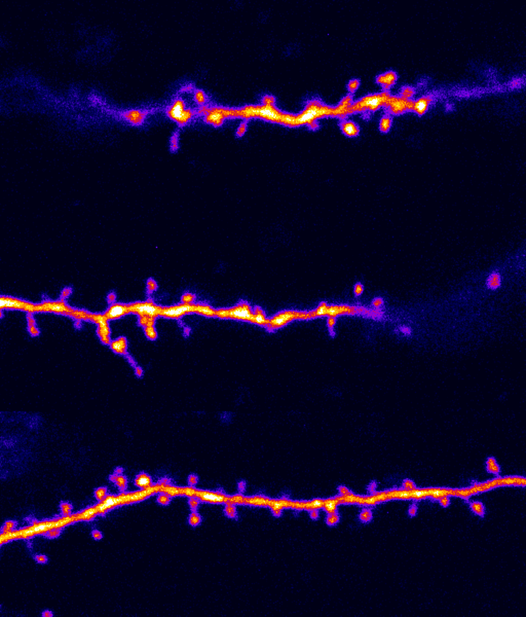 Synaptic turnover is both stable and dynamic