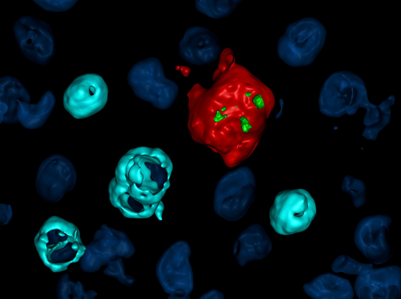 HIV reservoir in tissue macrophages: from myth to reality