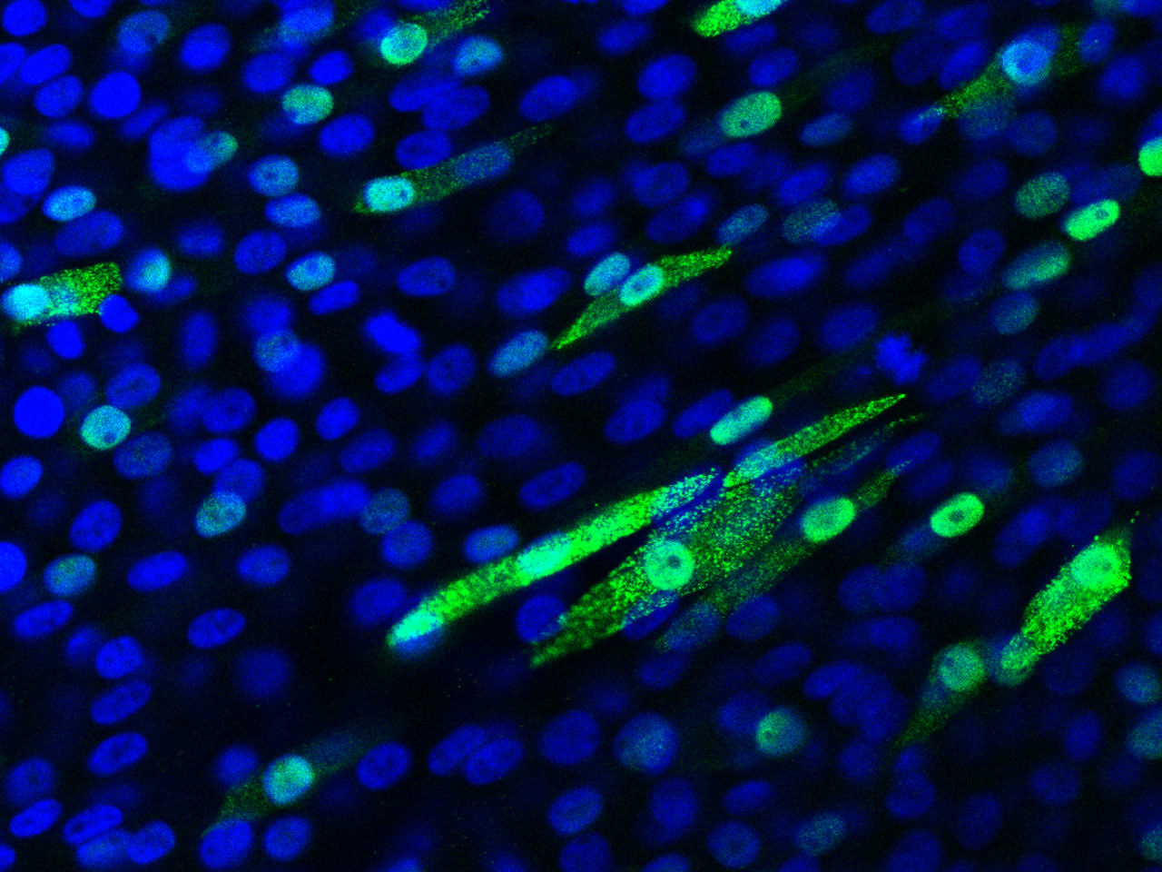 Host-cell kinases as targets for broad spectrum antivirals