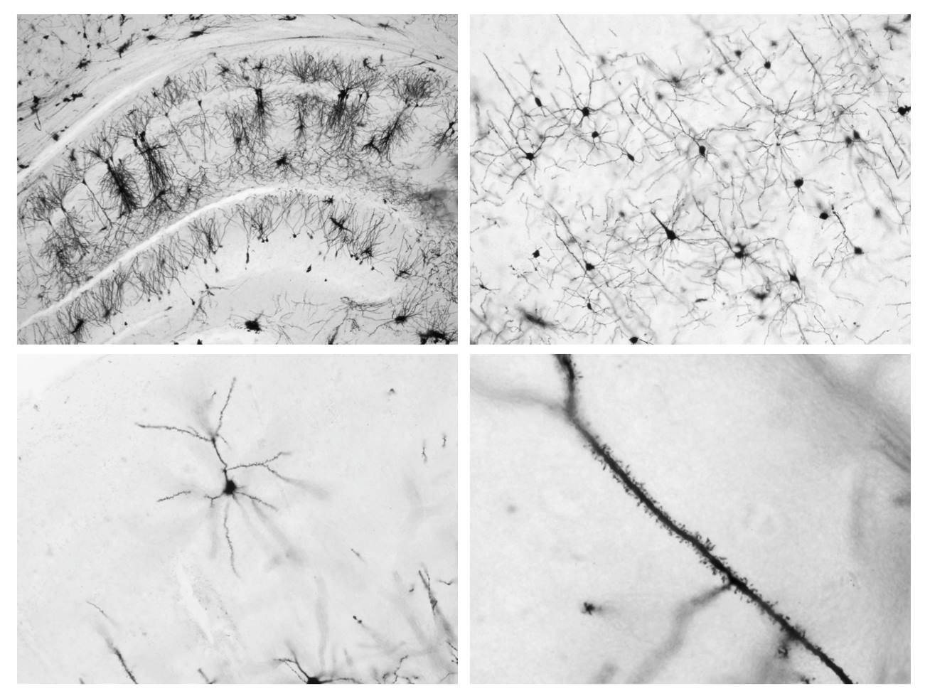  The Nightlight of Synapses: How the Brain Restores Electrical Balance In Sleep
