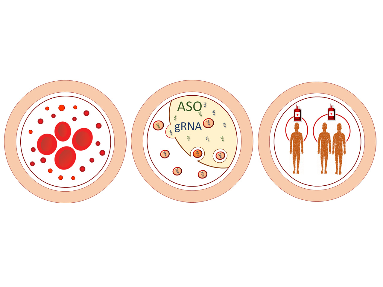 Harnessing red blood cell vesicles for gene therapies