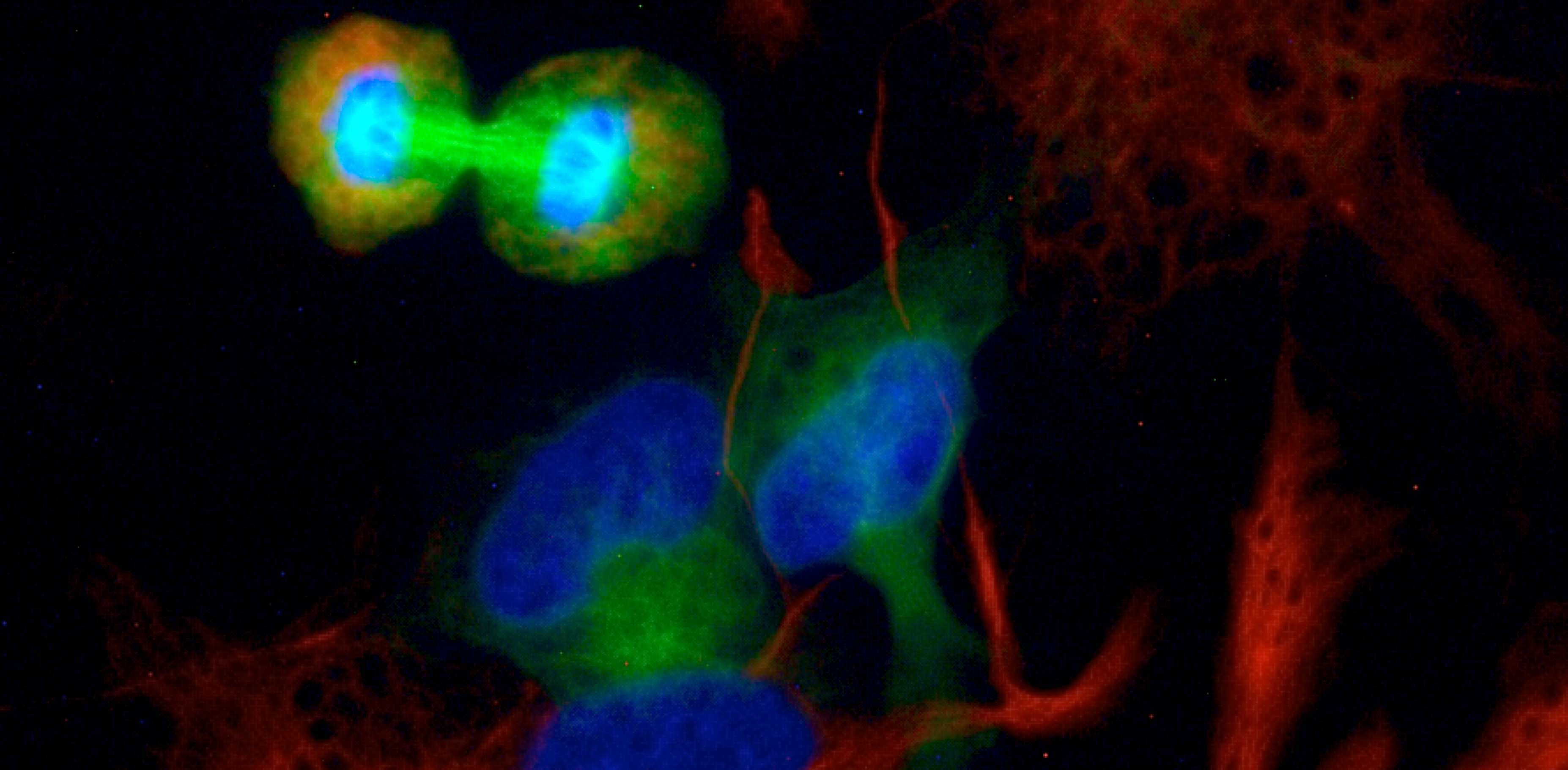 C1q-BAI1 signaling — a neural stem cell traffic light