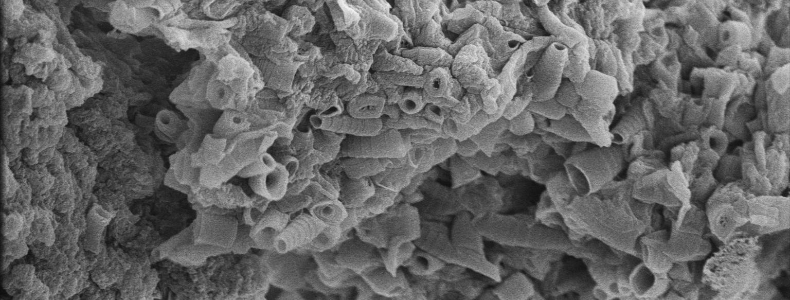R-bodies: enigmatic structures that turned out to be virulence factors in a notorious pathogen