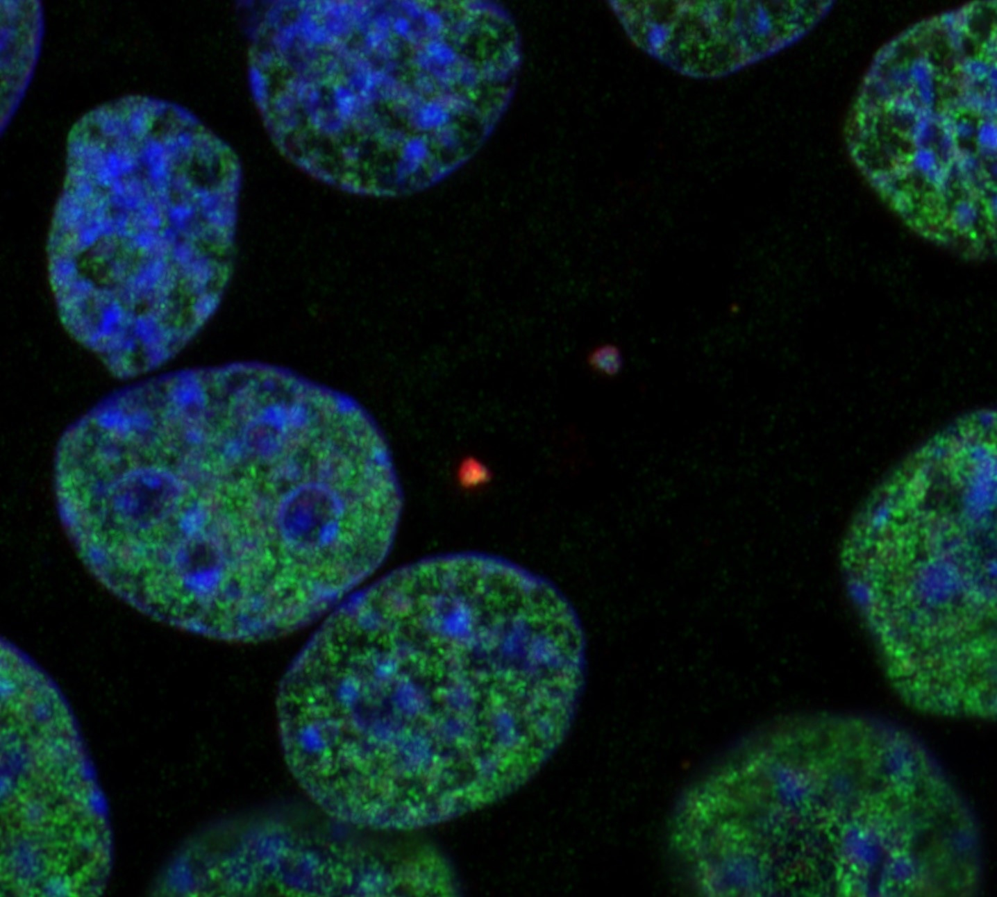Connecting the Dots: Epigenetic Abnormality and Chromosomal Instability in Cancer