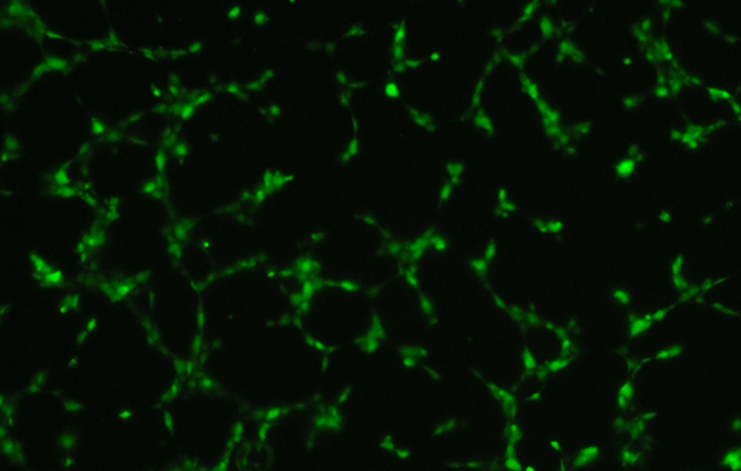 Mdm2-mediated neddylation of pVHL blocks the induction of antiangiogenic factors
