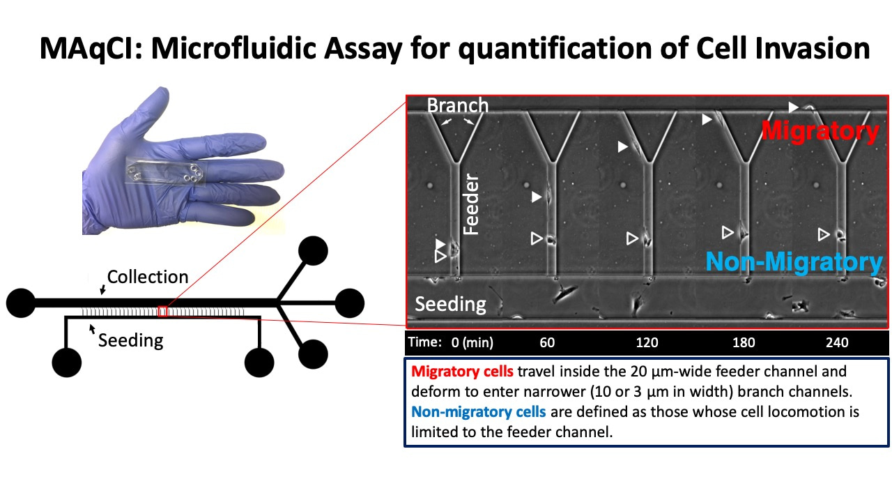 A microfluidic assay for the quantification of the metastatic propensity of breast cancer specimens
