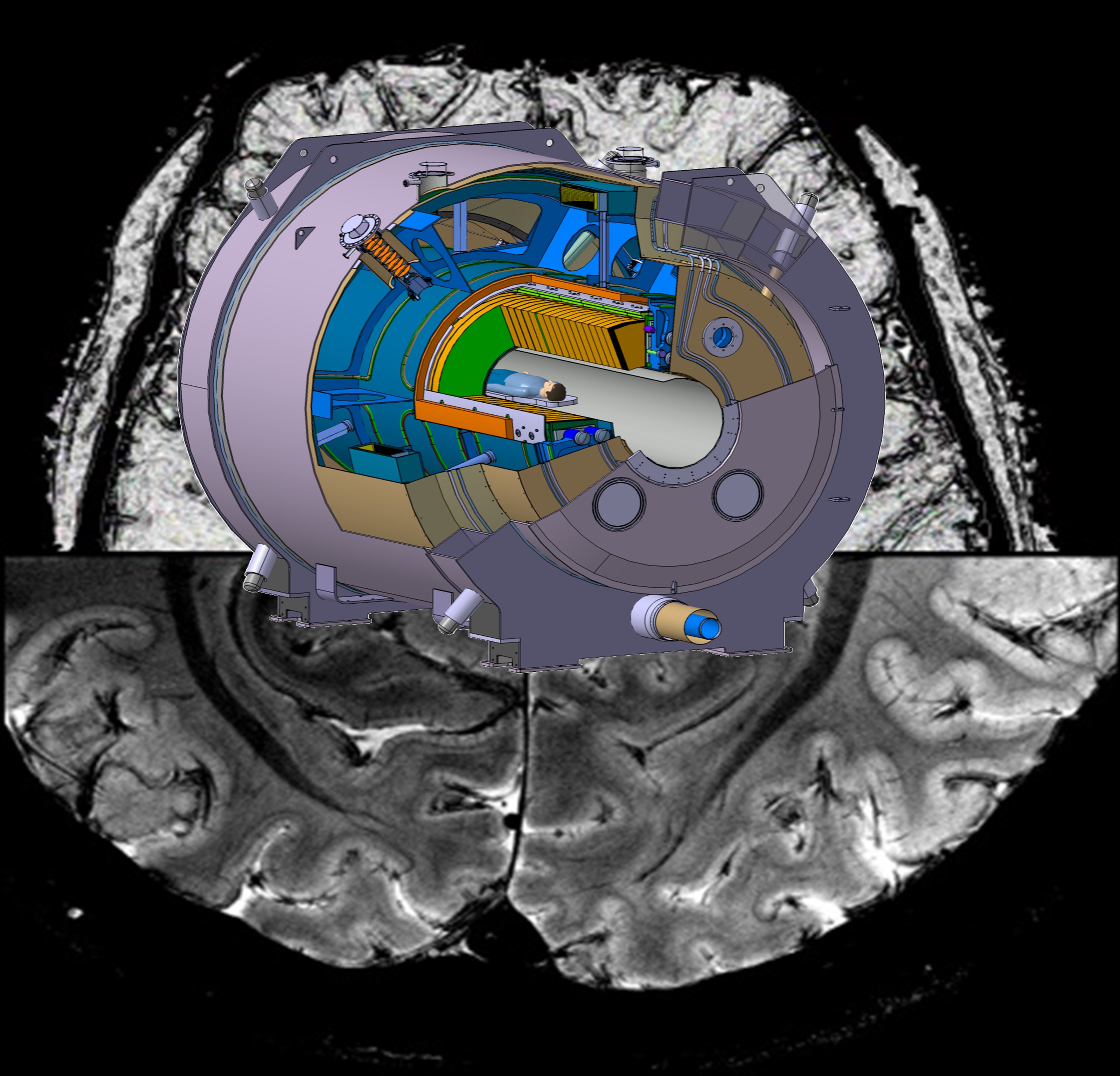Ultra-high field for fast imaging of the human brain at mesoscale resolution