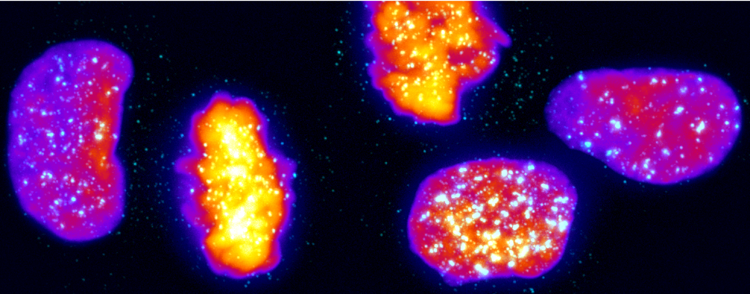 CENP-A overexpression promotes distinct fates in human cells, depending on p53 status