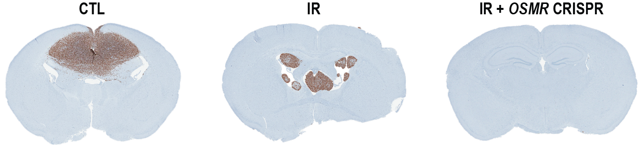 Metabolic reprogramming by a cytokine receptor confers glioblastoma resistance to therapy
