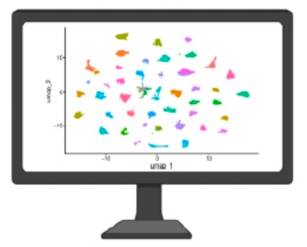 A single-cell view of pancreatic cancer diversity