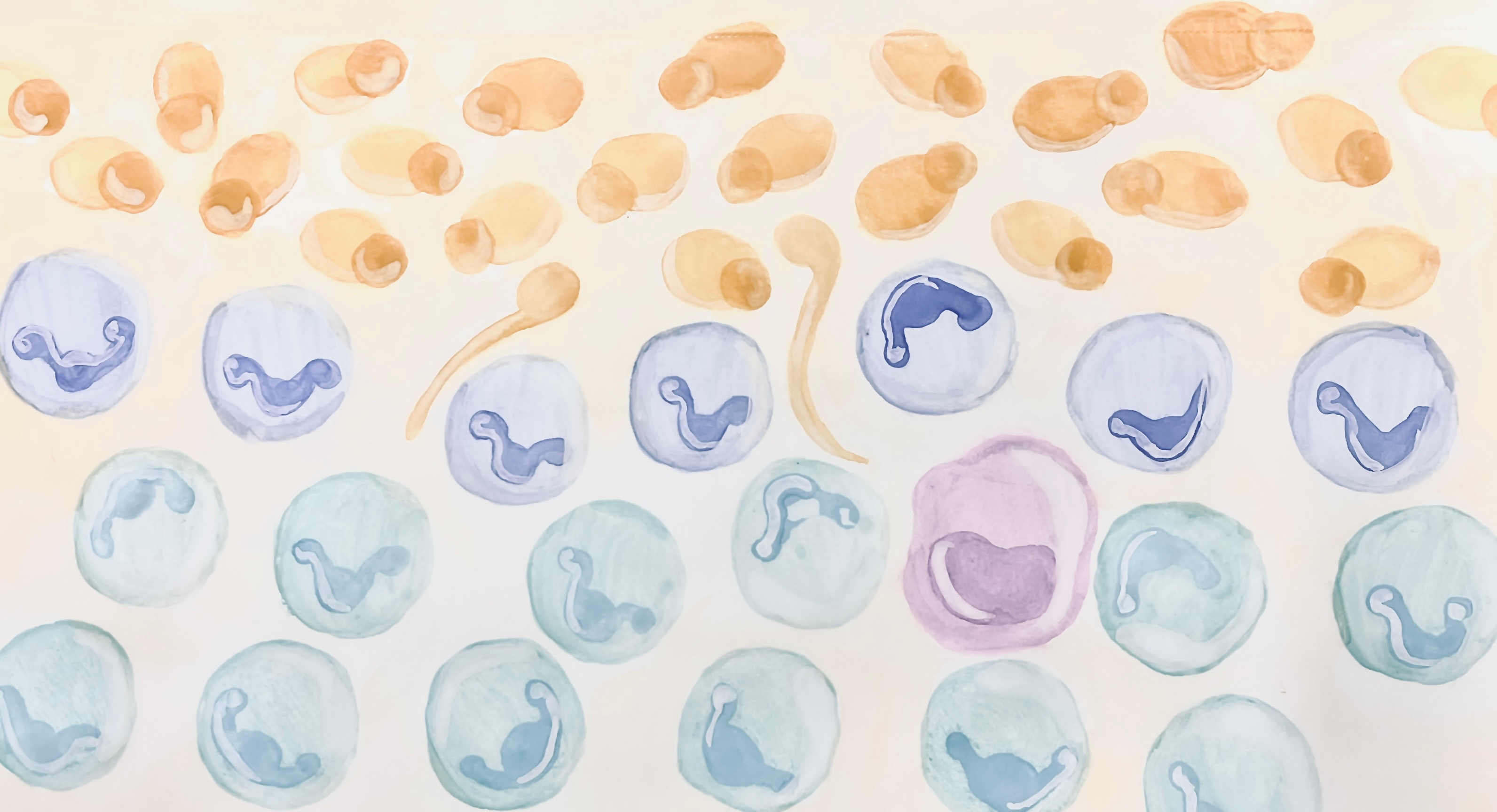 Lack of TYK2 Signaling Enhances Host Resistance to Candida albicans Skin Infection