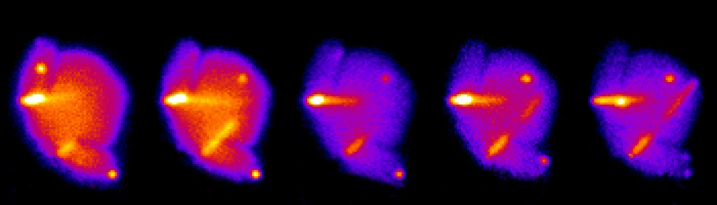 Size matters: supersized bacterial secretion system